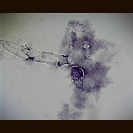 Philip Harris Prepared Microscope Slide - Amoeba proteus W.M.